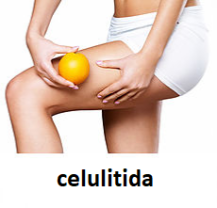Celulitida
